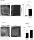 Fig. 18 - Prevention of tissue ischemia and related methods