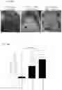Fig. 19 - Prevention of tissue ischemia and related methods