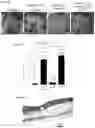 Fig. 22 - Prevention of tissue ischemia and related methods