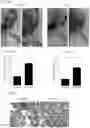 Fig. 26 - Prevention of tissue ischemia and related methods