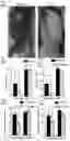 Fig. 45 - Prevention of tissue ischemia and related methods