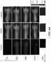 Fig. 22 - Photosensitizing antibody-fluorophore conjugates