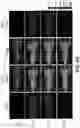 Fig. 25 - Photosensitizing antibody-fluorophore conjugates