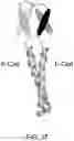 Fig. 33 - Deimmunized Serum-Binding Domains and Their Use in Extending Serum Half-Life