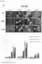 Fig. 11 - Method of producing cancer stem cells