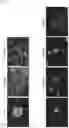Fig. 25 - Method of producing cancer stem cells