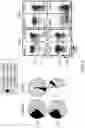 Fig. 06 - METHODS FOR MANUFACTURING T CELLS EXPRESSING OF CHIMERIC ANTIGEN RECEPTORS AND OTHER RECEPTORS