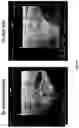 Fig. 10 - Method and composition for inducing chondrogenesis or tenogenesis in mesenchymal stem cells