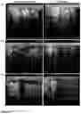 Fig. 14 - Method and composition for inducing chondrogenesis or tenogenesis in mesenchymal stem cells