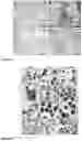 Fig. 16 - Method and composition for inducing chondrogenesis or tenogenesis in mesenchymal stem cells