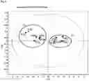 Fig. 10 - Method for producing adult liver progenitor cells