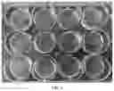 Fig. 02 - Method for circulating tumor cells isolation