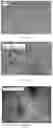 Fig. 07 - Method for circulating tumor cells isolation