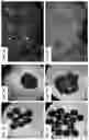 Fig. 12 - CELL SPHEROIDS CONTAINING CAPILLARY STRUCTURES AND METHODS OF USING SAME