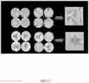 Fig. 15 - CELL SPHEROIDS CONTAINING CAPILLARY STRUCTURES AND METHODS OF USING SAME