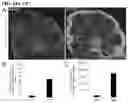 Fig. 20 - Adeno-associated virus capsid variants and methods of use thereof