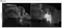 Fig. 21 - Adeno-associated virus capsid variants and methods of use thereof