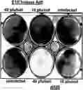 Fig. 01 - Use of adenovirus and nucleic acids coding therefor