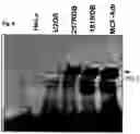 Fig. 07 - Use of adenovirus and nucleic acids coding therefor