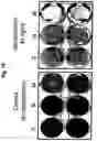 Fig. 11 - Use of adenovirus and nucleic acids coding therefor