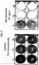 Fig. 12 - Use of adenovirus and nucleic acids coding therefor