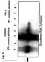 Fig. 15 - Use of adenovirus and nucleic acids coding therefor