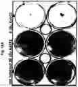 Fig. 19 - Use of adenovirus and nucleic acids coding therefor