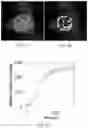 Fig. 11 - Disordered protein-based seeds for molecular clustering