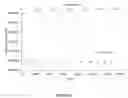 Fig. 06 - Methods for purification of messenger RNA