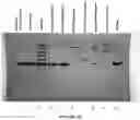 Fig. 11 - Methods for purification of messenger RNA
