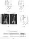 Fig. 12 - Methods and compositions for managing vascular conditions