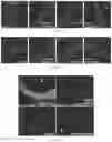 Fig. 17 - Methods and compositions for managing vascular conditions