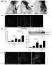 Fig. 02 - Method for inhibiting calcification of a smooth muscle cell (SMC)
