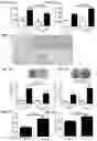 Fig. 03 - Method for inhibiting calcification of a smooth muscle cell (SMC)