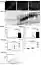 Fig. 06 - Method for inhibiting calcification of a smooth muscle cell (SMC)