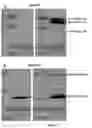 Fig. 18 - Expression of nitrogenase polypeptides in plant cells