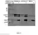 Fig. 20 - Expression of nitrogenase polypeptides in plant cells