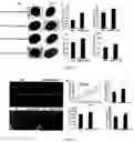 Fig. 04 - CORN GENES ZMSPL1 AND ZMSPL2 AND USES THEREOF