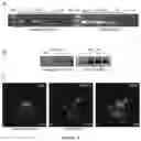 Fig. 07 - Gene-therapy vectors for treating cardiomyopathy