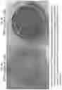 Fig. 06 - Method for generating retinal pigment epithelium (RPE) cells from induced pluripotent stem cells (IPSCs)