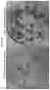 Fig. 16 - Method for generating retinal pigment epithelium (RPE) cells from induced pluripotent stem cells (IPSCs)