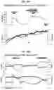 Fig. 29 - Method for generating retinal pigment epithelium (RPE) cells from induced pluripotent stem cells (IPSCs)