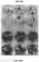 Fig. 40 - Method for generating retinal pigment epithelium (RPE) cells from induced pluripotent stem cells (IPSCs)
