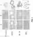 Fig. 02 - GRADING OF BREAST CANCER