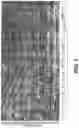 Fig. 05 - GRADING OF BREAST CANCER