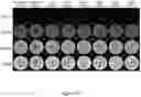 Fig. 11 - Platinum-nickel-based alloys, products, and methods of making and using same