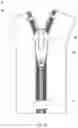Fig. 24 - Electroplating method