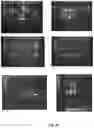 Fig. 75 - High-throughput immune sequencing