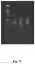 Fig. 87 - High-throughput immune sequencing