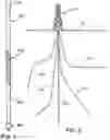 Fig. 02 - Helical hardbanding